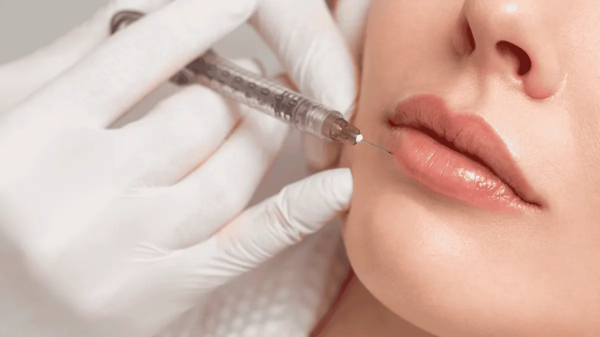 Preenchimento Labial Avançado: Naturalidade E Hidratação
